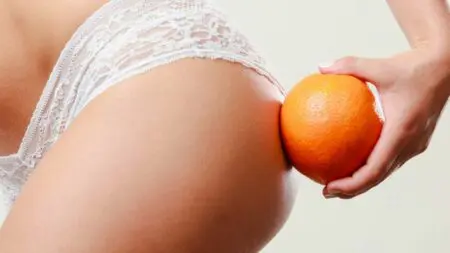 ¿Cómo perder la celulitis?